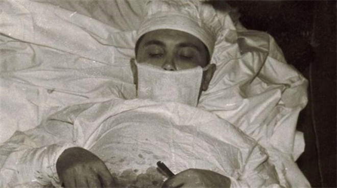 27 yaşındaki Leonid Rogozov isimli doktor, şiddetli ağrılar yaşadığı bir sabaha uyandı. Ağrılarına kendi teşhis koyan genç doktor, ağrıların sebebinin apandisitten kaynaklandığını düşünerek, kendisini ameliyat etmeye karar verdi. Doktor, bu hareketiyle dünyada kendini ameliyat eden ilk doktor olarak tarihe geçti ve 'Order of the Red Banner of Labour' ödülüne layık görüldü.